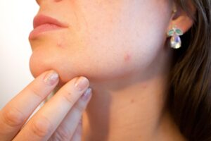 毛穴の開きや黒ずみを改善するための効果的なスキンケア方法は？