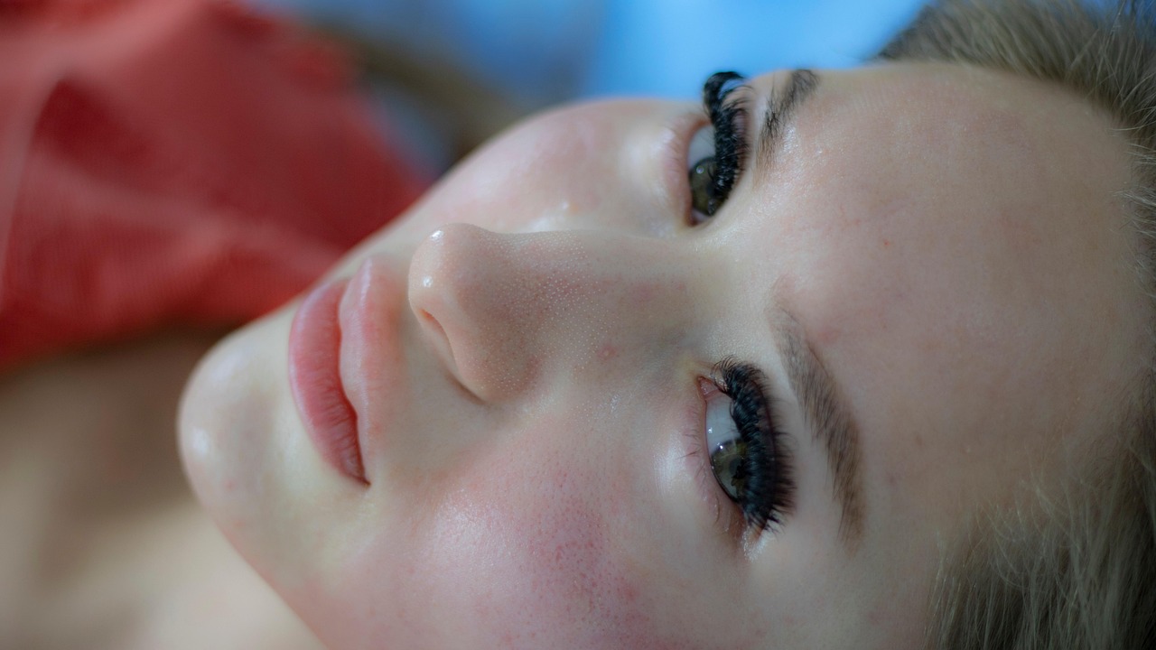 ニキビ跡に効果的なスキンケアとしてのレチノールの使い方は？