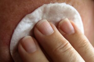 30代の敏感肌におすすめのスキンケア注意点は？